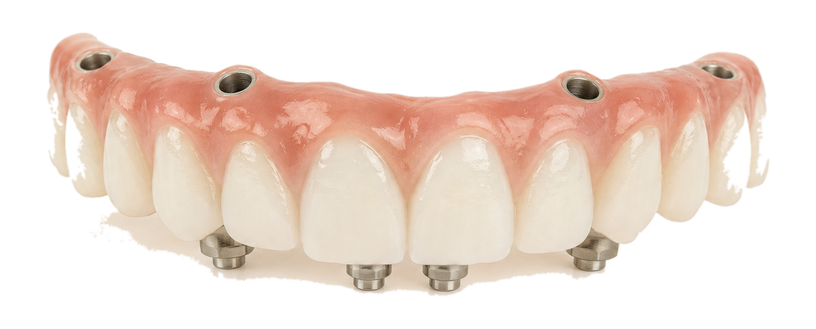 Transparent All on 4 fixed provisional bridge.
