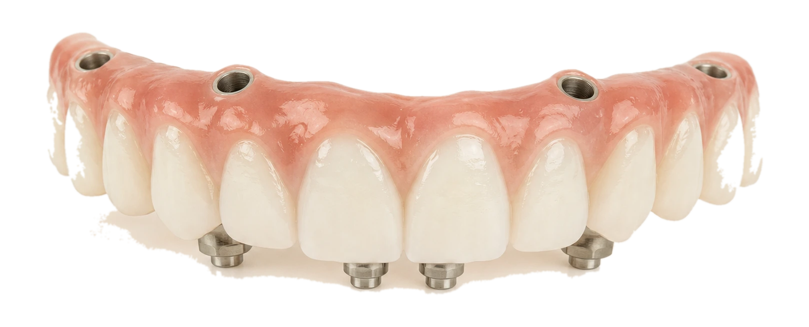 Transparent All on 4 fixed provisional bridge.