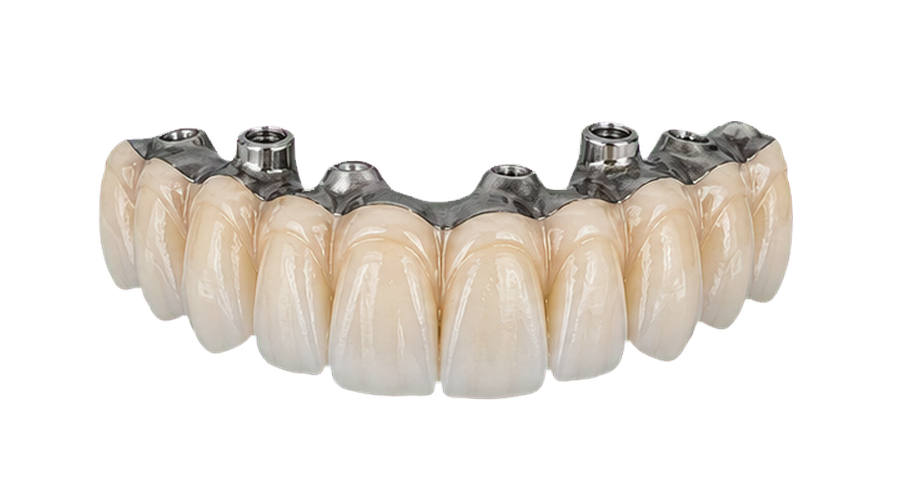 Porcelain full-arch bridge material option.