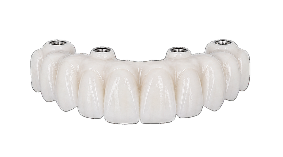 Close view of a white monolithic zirconia-style bridge surface.