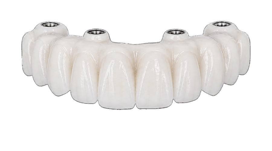 Zirconia All on 4 bridge with white monolithic ceramic teeth and implant screw access.