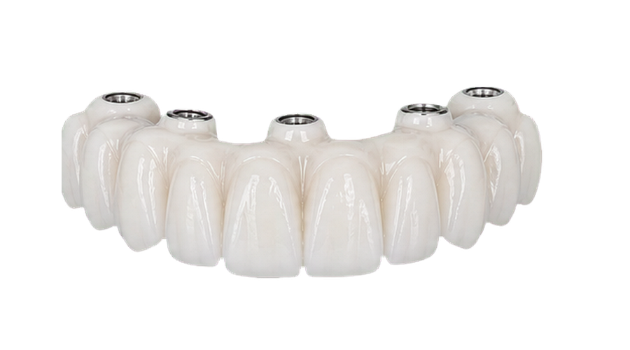 Zirconia full-arch bridge material option.