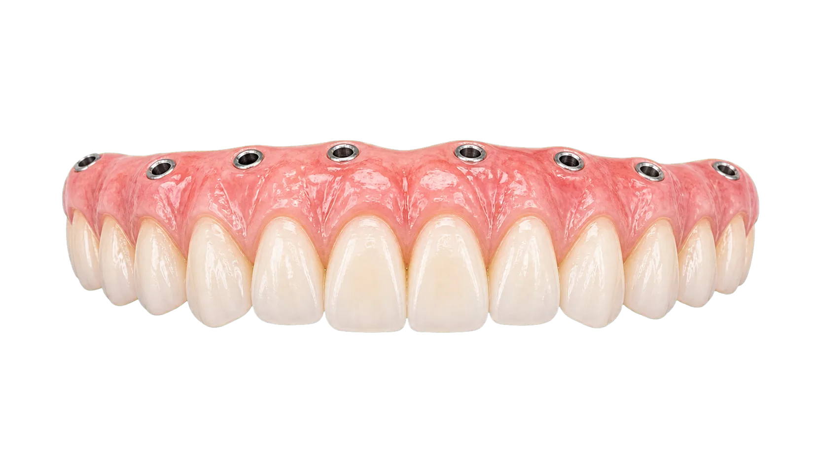 Transparent All on 8 implant-supported arch planning visual.