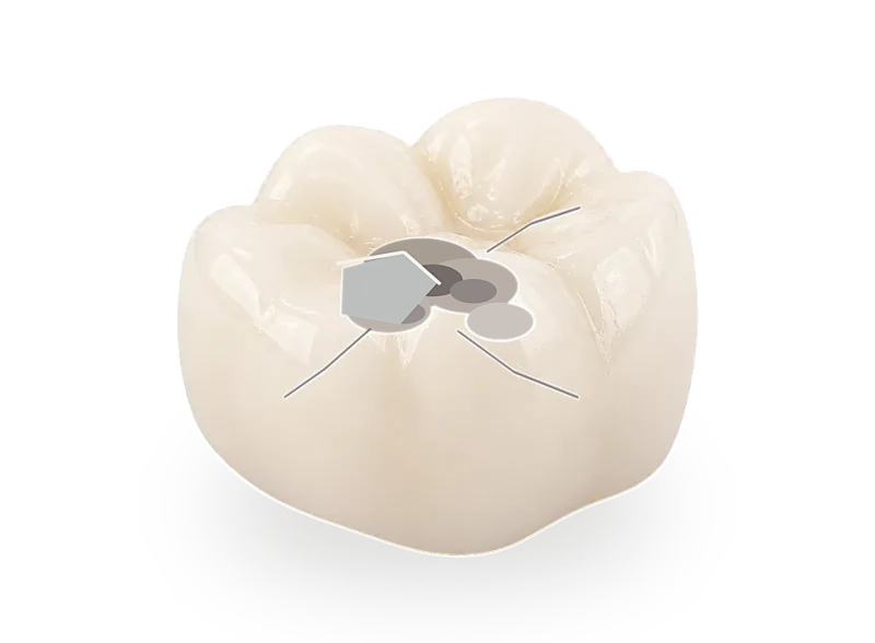 Compromised tooth before restoration decision.