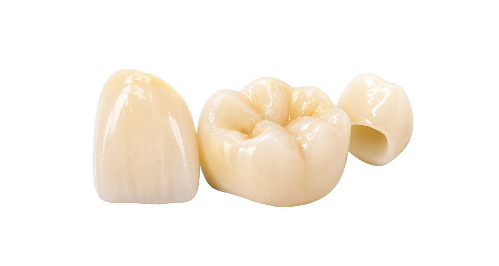 Transparent dental crown visual for single-tooth reconstruction.