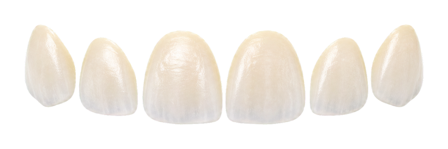 Transparent veneer shell visual for cosmetic surface design.